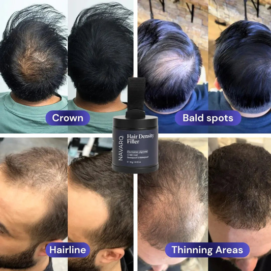 Navaro Hair Density Filler