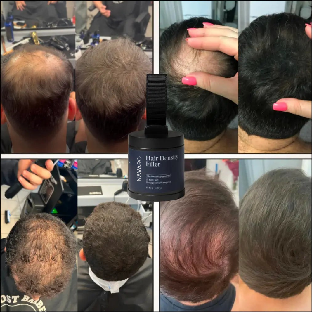 Navaro Hair Density Filler