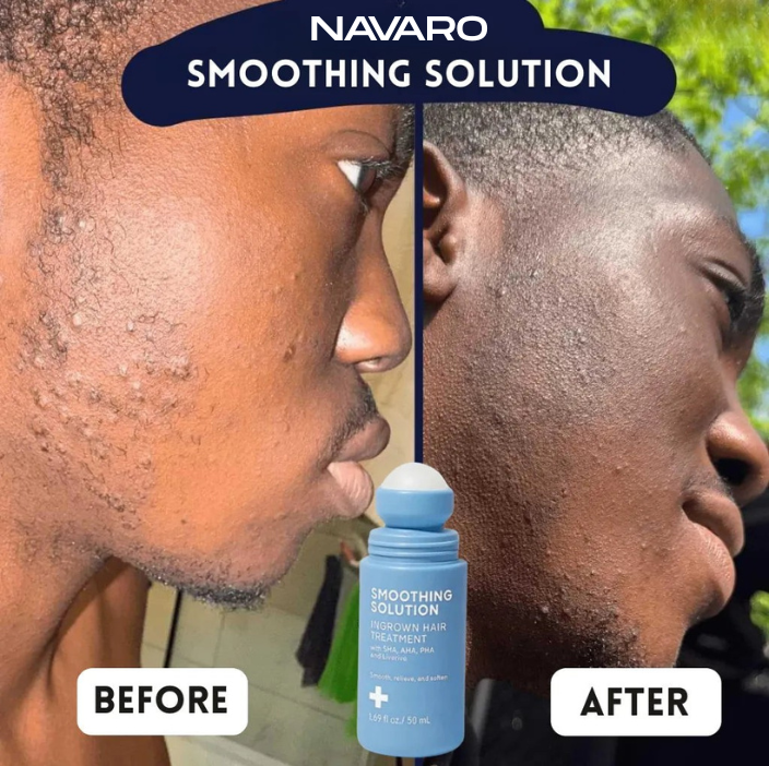 Navaro Anti-Bump Serum