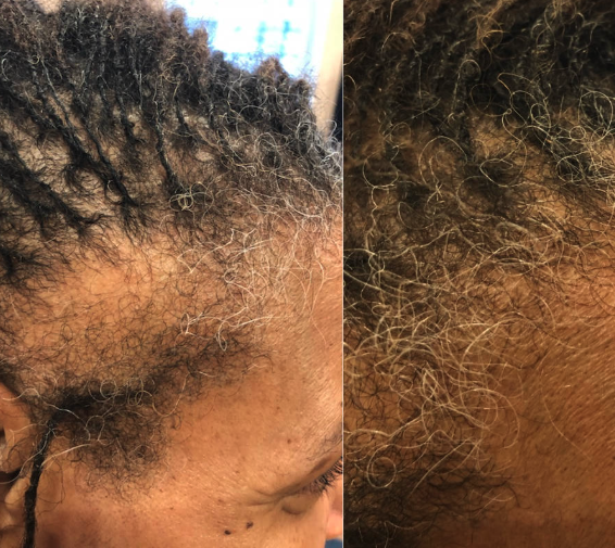 Navaro Hair Growth Serum