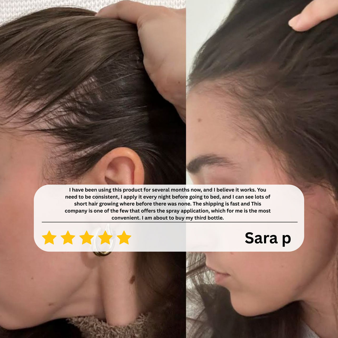 Navaro Hair Growth Serum