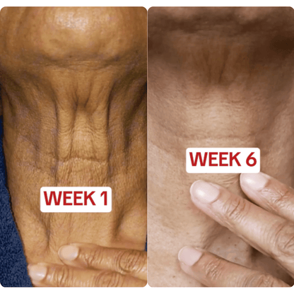 Navaro™ Collagen Lifting Ampoule