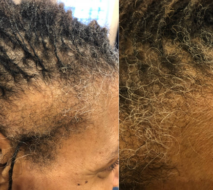 Navaro Hair Growth Serum