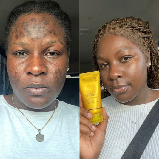 Kojic Acid Tumeric Night Wrapping Mask