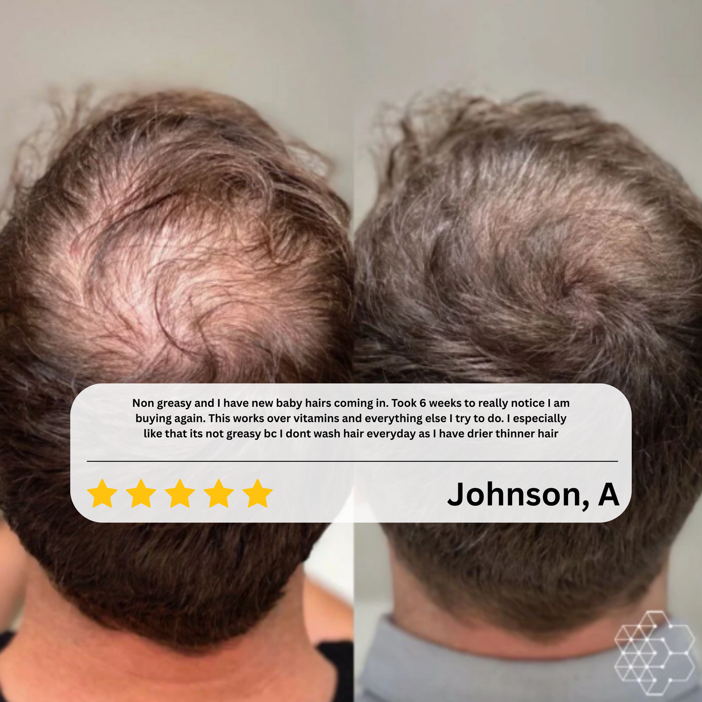 Navaro Hair Growth Serum