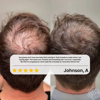 Navaro Hair Growth Serum